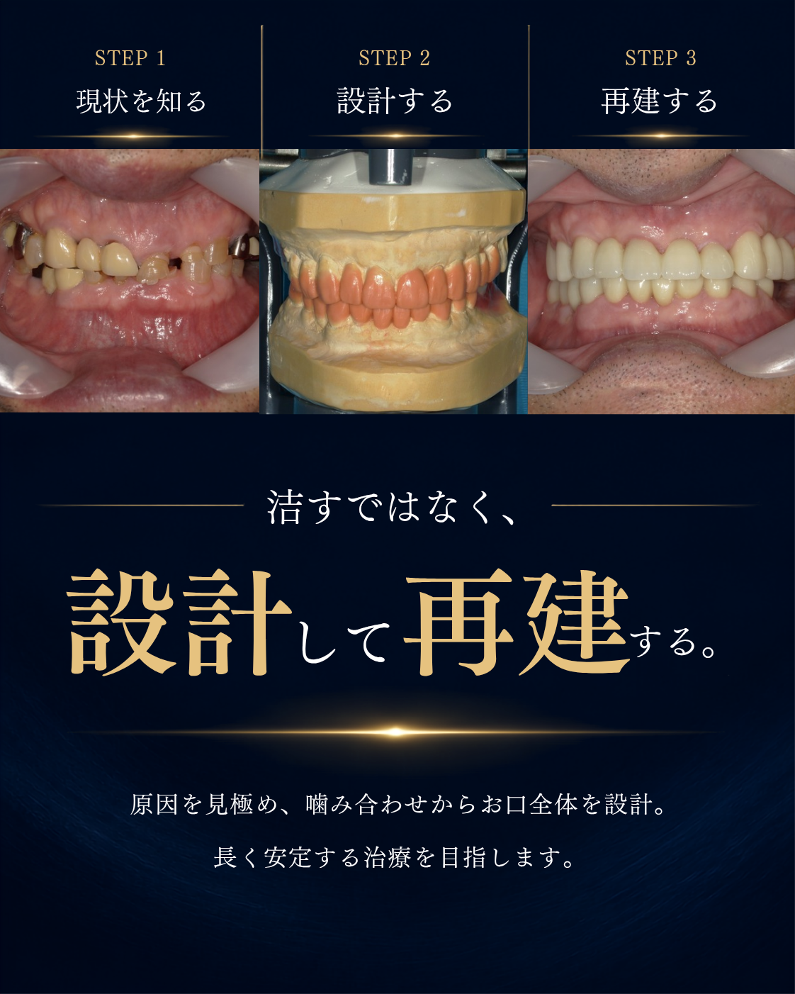 北上市で噛み合わせの再設計治療を行う北上しらゆりデンタルクリニック